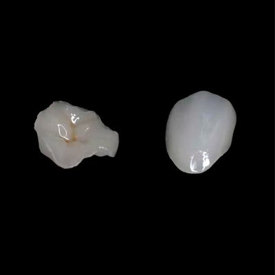 Cera Aesthetics Dental Glass Ceramics Glass Ceramic Crowns Dental Consumables