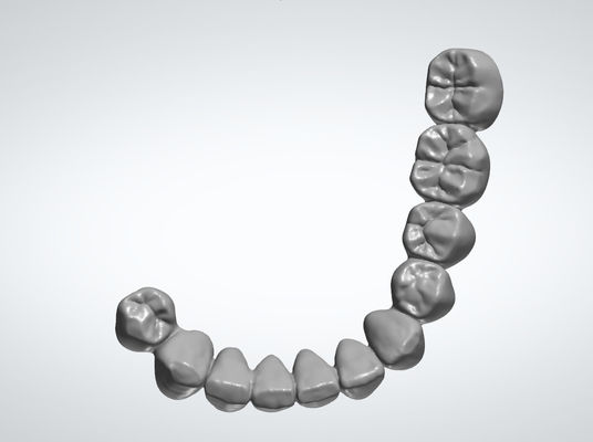 Custom Dental Design Service Abutments Braces Design Dental Lab