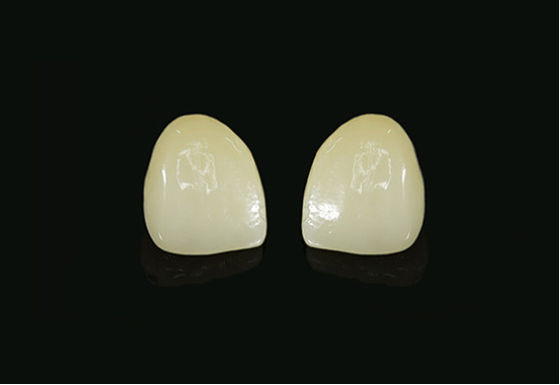 Digital Dentistry Dental Glass Ceramics 420MPa  Restorations Glass Ceramic Veneer