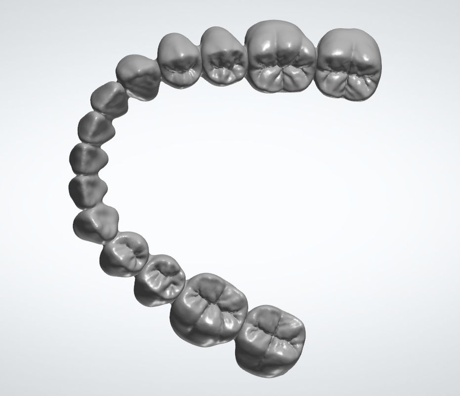 Restoration EXO Dental Design Service Dental Brace Crown Dental Interior Design