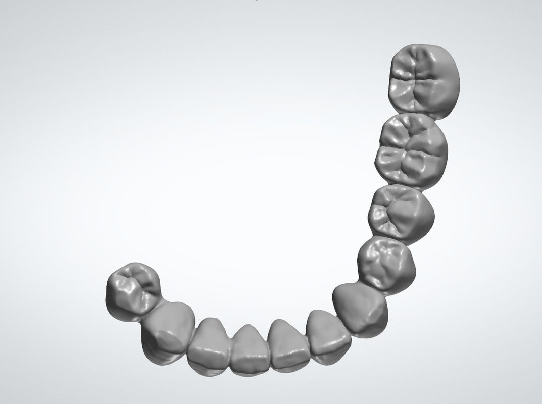 Custom Dental Design Service Abutments Braces Design Dental Lab