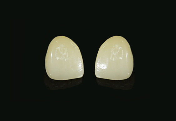 Digital Dentistry Dental Glass Ceramics 420MPa  Restorations Glass Ceramic Veneer