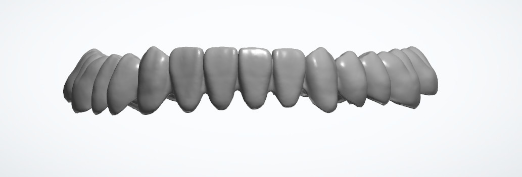 Custom Dental Design Service Abutments Braces Design Dental Lab