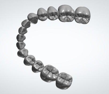 Buen precio Servicio de diseño dental de restauración EXO Diseño de interiores de coronas dental en línea